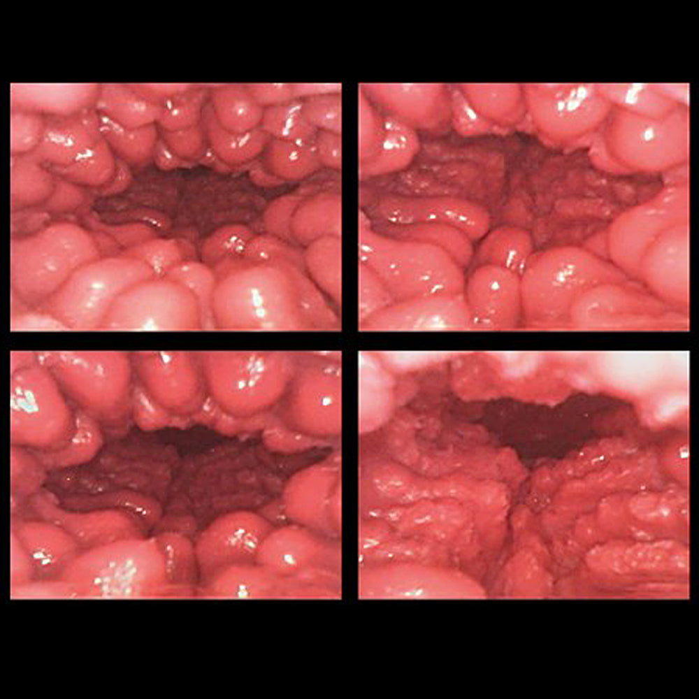 Yumenamagoshi Dream Hip